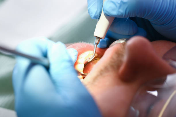 Best Orthodontic Emergency Dentist in Assumption, IL