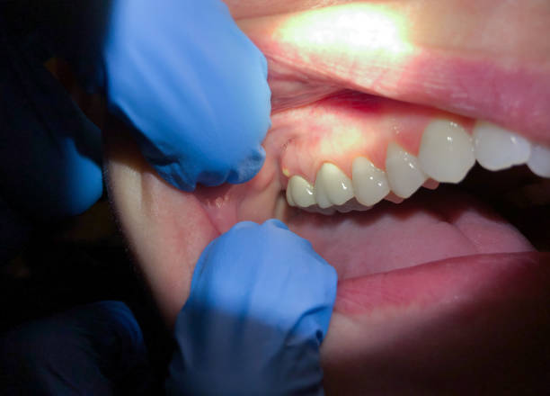  Assumption, IL Emergency Dentist Pros