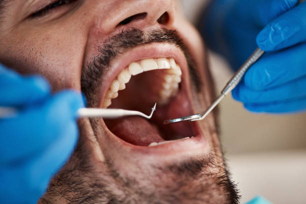 Best Emergency Cosmetic Dentistry in Assumption, IL